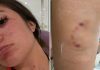 Denuncian Cruel Ataque de Perro Husky a Lomito Callejero en Tonalá