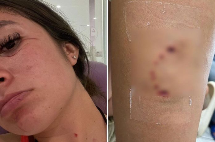 Mujer_atacada_perro_e8fea192c5